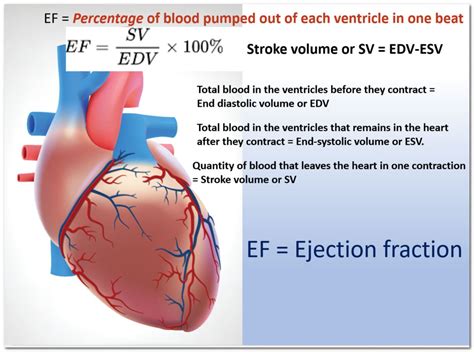 Ejection fraction